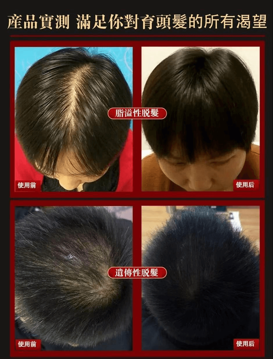 皙蘭朵防脫育髮液1709362947212491.png 皙蘭朵防脫育髮液