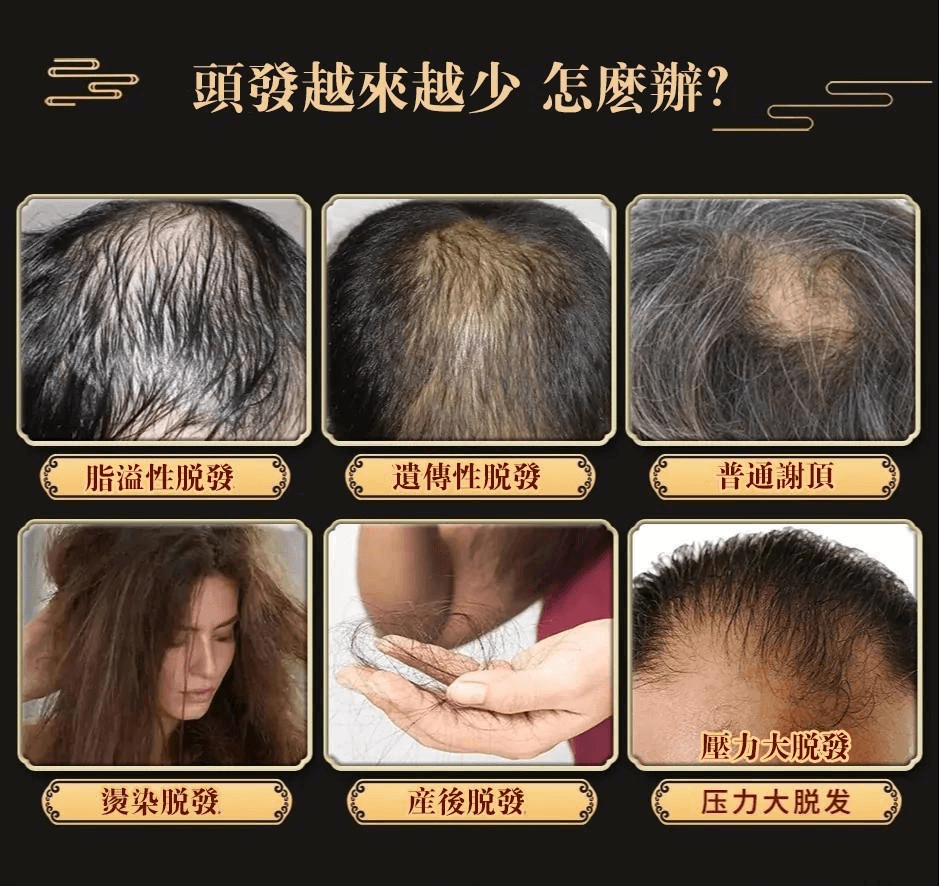 皙蘭朵防脫育髮液1709362947500517.png 皙蘭朵防脫育髮液
