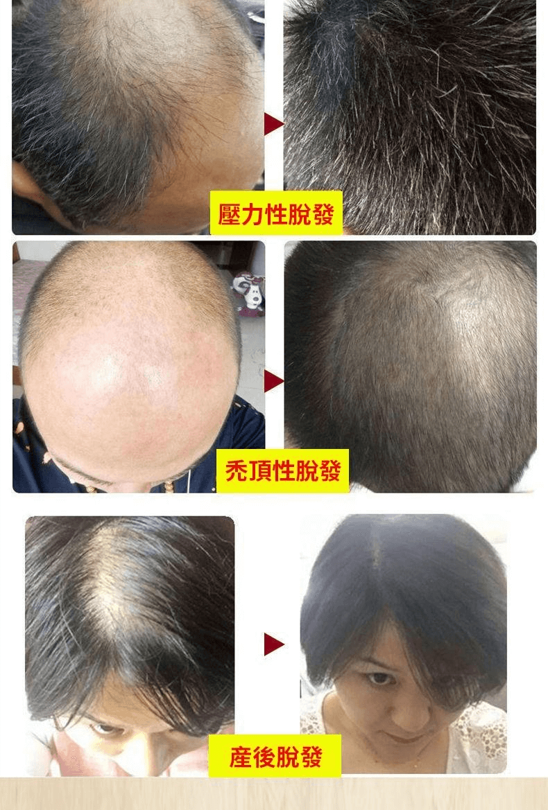 皙蘭朵防脫育髮液1709362947704770.png 皙蘭朵防脫育髮液