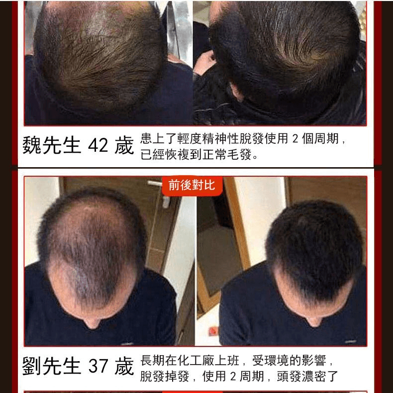 皙蘭朵防脫育髮液1709362947792029.png 皙蘭朵防脫育髮液