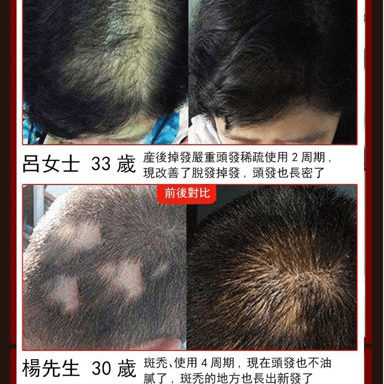 皙蘭朵防脫育髮液1709362947819096.png 皙蘭朵防脫育髮液